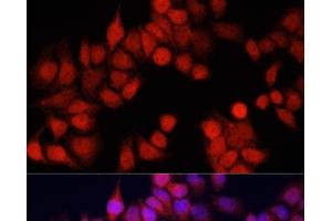 Immunofluorescence analysis of HeLa cells using CSTB Polyclonal Antibody at dilution of 1:100. (CSTB 抗体)
