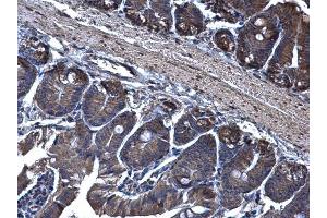 Immunohistochemistry (IHC) image for anti-Translocation Associated Membrane Protein 1 (TRAM1) (C-Term) antibody (ABIN2856617)