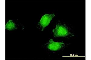 Immunofluorescence of monoclonal antibody to EDC4 on HeLa cell. (EDC4 抗体  (AA 1302-1401))