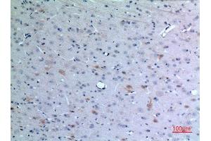 Immunohistochemistry (IHC) analysis of paraffin-embedded Rat Brain, antibody was diluted at 1:100. (CCL26 抗体  (Internal Region))