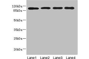 Western blot All lanes: USP26 antibody at 5. (USP26 抗体  (AA 664-913))