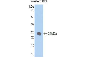 Western blot analysis of the recombinant protein. (Cytokeratin 1 抗体  (AA 350-488))