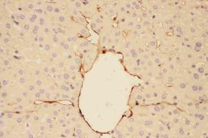 Immunohistochemistry (IHC) image for anti-Adiponectin (ADIPOQ) (AA 19-244) antibody (ABIN3042521)