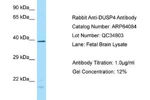 Western Blotting (WB) image for anti-Dual Specificity Phosphatase 4 (DUSP4) (N-Term) antibody (ABIN2789727) (DUSP4 抗体  (N-Term))