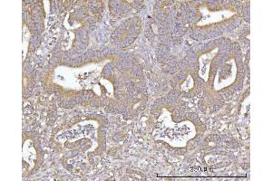 IHC analysis of SLU7 using anti-SLU7 antibody (ABIN7601697).