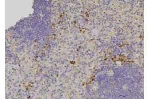 ABIN6278656 at 1/100 staining Human lymph node tissue by IHC-P. (OXSR1 抗体  (pThr185))