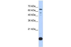 Thioredoxin 2 antibody used at 1 ug/ml to detect target protein. (TXN2 抗体  (Middle Region))