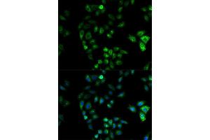 Immunofluorescence (IF) image for anti-Hydroxysteroid (17-Beta) Dehydrogenase 2 (HSD17B2) (AA 118-387) antibody (ABIN3015795)