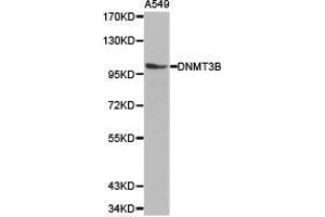 Western Blotting (WB) image for anti-DNA (Cytosine-5-)-Methyltransferase 3 beta (DNMT3B) antibody (ABIN1872328) (DNMT3B 抗体)