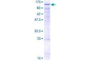 NADSYN1 Protein (AA 1-706) (GST tag)