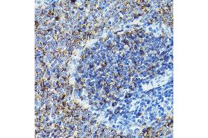Immunohistochemistry of paraffin-embedded rat spleen using CD79B Rabbit pAb (ABIN3022745, ABIN3022746, ABIN3022747 and ABIN6219206) at dilution of 1:100 (40x lens). (CD79b 抗体  (AA 29-159))