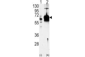 Western Blotting (WB) image for anti-Guanylate Cyclase 1 Soluble Subunit Alpha (GUCY1A1) antibody (ABIN3003008) (GUCY1A1 抗体)