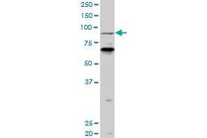 PCAF monoclonal antibody (M04), clone 5E11. (KAT2B 抗体  (AA 353-452))