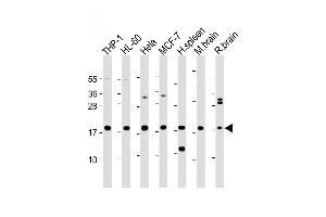 All lanes : Anti-ARPC5 Antibody (Center) at 1:2000 dilution Lane 1: THP-1 whole cell lysate Lane 2: HL-60 whole cell lysate Lane 3: Hela whole cell lysate Lane 4: MCF-7 whole cell lysate Lane 5: Human spleen lysate Lane 6: Mouse brain lysate Lane 7: Rat brain lysate Lysates/proteins at 20 μg per lane. (ARPC5 抗体  (AA 67-101))
