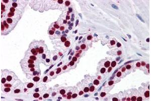 Human Prostate: Formalin-Fixed, Paraffin-Embedded (FFPE) (SMAD6 抗体  (AA 285-385))