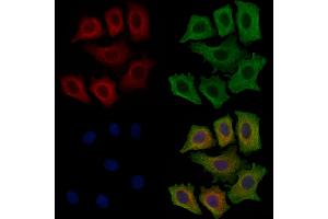 ABIN6256276 and ABIN6267430 staining HepG2 cells(4h of LPS treatment) by IF/ICC.
