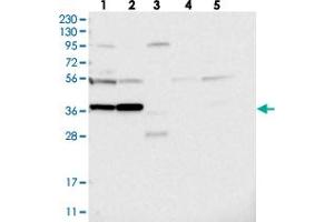 Western blot analysis of Lane 1: RT-4, Lane 2: U-251 MG, Lane 3: Human Plasma, Lane 4: Liver, Lane 5: Tonsil with PRUNE2 polyclonal antibody  at 1:250-1:500 dilution. (PRUNE2 抗体)