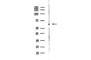 Western blot analysis of lysates from HUVEC cells(LPS,4h treatment), using Lgi1 Antibody at 1/1000 dilution.