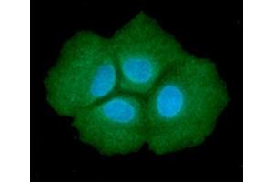 ICC/IF analysis of ADSL in Hep3B cells line, stained with DAPI (Blue) for nucleus staining and monoclonal anti-human ADSL antibody (1:100) with goat anti-mouse IgG-Alexa fluor 488 conjugate (Green). (Adenylosuccinate Lyase 抗体)