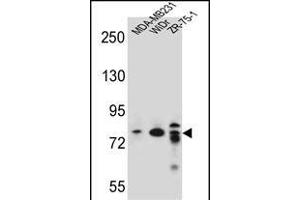 ARHG Antibody (C-term) (ABIN656937 and ABIN2846128) western blot analysis in MDA-M,WiDr,ZR-75-1 cell line lysates (35 μg/lane). (ARHGAP22 抗体  (C-Term))