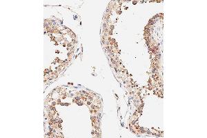 Immunohistochemical analysis of paraffin-embedded human testis tissue using B performed on the Leica® BOND RXm. (DLL3 抗体  (C-Term))