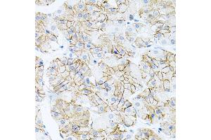Immunohistochemistry of paraffin-embedded human stomach using IL17A antibody (ABIN6290529) at dilution of 1:100 (40x lens). (Interleukin 17a 抗体)