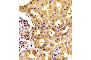 (ABIN6242522 and ABIN6577190) staining PGK1 in human kidney tissue sections by Immunohistochemistry (IHC-P - paraformaldehyde-fixed, paraffin-embedded sections). (PGK1 抗体  (AA 1-417))