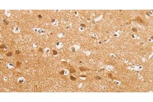 Immunohistochemistry of paraffin-embedded Human brain using K-Cadherin Polyclonal Antibody at dilution of 1:50 (CDH6 抗体)