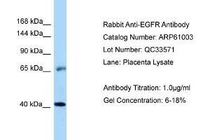 Western Blotting (WB) image for anti-Epidermal Growth Factor Receptor (EGFR) (Middle Region) antibody (ABIN2788648) (EGFR 抗体  (Middle Region))