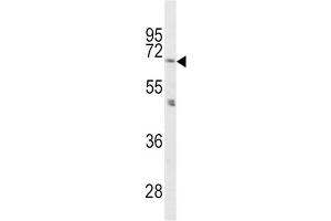 Western Blotting (WB) image for anti-Proprotein Convertase Subtilisin/kexin Type 2 (PCSK2) antibody (ABIN3003341)