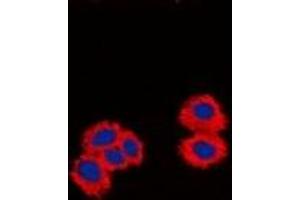 Immunofluorescent analysis of CPI17 staining in Jurkat cells.