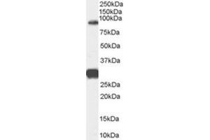 Image no. 1 for anti-Forkhead Box P2 (FOXP2) (Internal Region) antibody (ABIN375200) (FOXP2 抗体  (Internal Region))