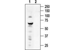 Western blot analysis of ND7/23 Mouse neuroblastoma /rat dorsal root ganglion neuron hybrid cell line lysate: - 1. (TRPV4 抗体  (C-Term, Intracellular))