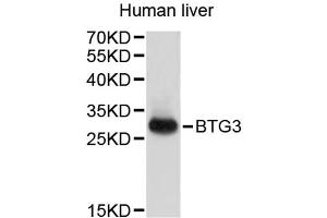 Western blot analysis of extracts of human liver, using BTG3 antibody (ABIN3048296). (BTG3 抗体)