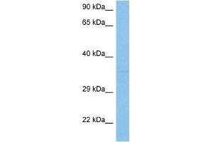 Host:  Mouse  Target Name:  SIRT6  Sample Tissue:  Mouse Skeletal Muscle  Antibody Dilution:  1ug/ml (SIRT6 抗体  (N-Term))