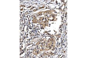 IHC analysis of TBP-1/PSMC3 using anti-TBP-1/PSMC3 antibody (ABIN7599393).