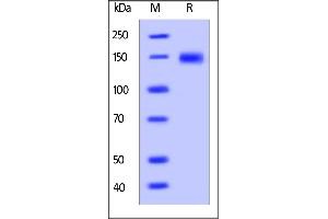 Cynomolgus LDL R, His Tag on  under reducing (R) condition.