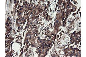 Image no. 14 for anti-Ubiquitin-Conjugating Enzyme E2, J1, U (UBE2J1) antibody (ABIN1501638)