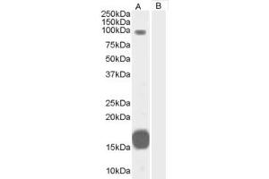 Western Blotting (WB) image for anti-rho GTPase Activating Protein 26 (ARHGAP26) (C-Term) antibody (ABIN2465789) (GRAF 抗体  (C-Term))