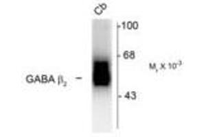 Image no. 1 for anti-gamma-aminobutyric Acid (GABA) A Receptor, beta 2 (GABRB2) (Cytoplasmic Domain) antibody (ABIN228403) (GABRB2 抗体  (Cytoplasmic Domain))