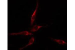ABIN6275113 staining HepG2 cells by IF/ICC. (Epsin 2 抗体  (Internal Region))