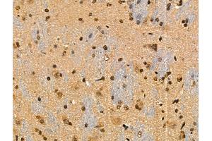 Phospho-IRF7 (Ser471/Ser472) Antibody at 1/100 staining Rat brain tissue by IHC-P. (IRF7 抗体  (pSer471, pSer472))