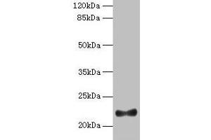 Western blot All lanes: IFNAG antibody at 2 μg/mL + HL60 whole cell lysate Secondary Goat polyclonal to rabbit IgG at 1/10000 dilution Predicted band size: 22 kDa Observed band size: 22 kDa (IFNA5 抗体  (AA 24-189))
