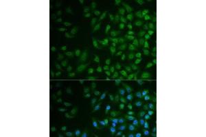 Immunofluorescence analysis of MCF7 cells using MPP2 Polyclonal Antibody (MPP2 抗体)