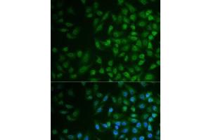 Immunofluorescence analysis of MCF7 cells using MPP2 Polyclonal Antibody (MPP2 抗体)