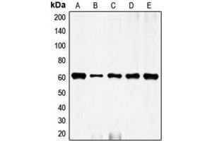 Western blot analysis of c-FOS expression in HeLa (A), NIH3T3 (B), mouse brain (C), rat kidney (D), rat brain (E) whole cell lysates. (c-FOS 抗体  (N-Term))