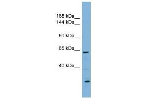 Klotho antibody used at 1 ug/ml to detect target protein. (Klotho 抗体  (N-Term))