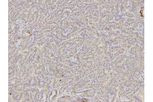 Immunohistochemistry (IHC) image for anti-DKK3 antibody (ABIN1872281) (DKK3 抗体)