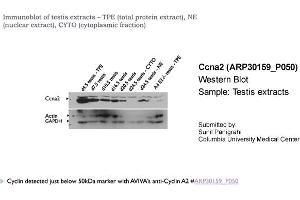 Western Blotting (WB) image for anti-Cyclin A2 (CCNA2) (C-Term) antibody (ABIN2779289) (Cyclin A 抗体  (C-Term))
