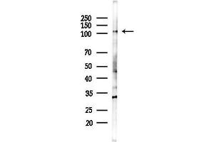 anti-Eukaryotic Translation Initiation Factor 2C, 1 (EIF2C1) (Internal Region) antibody
